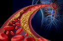 HDL colesterol, conhecido como "bom colesterol", pode aumentar risco de morte, sugere estudo