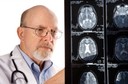 Infartos cerebrais silenciosos impactam na função cognitiva em pacientes com fibrilação atrial