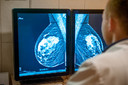 Mortalidade por câncer de mama reduziu 58% nas últimas quatro décadas