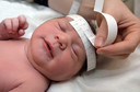 Pesquisadores suspeitam que uma nova síndrome pode estar associada à exposição pré-natal ao fentanil