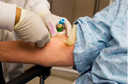 Sociedade Brasileira de Hematologia e Hemoterapia (SBHH) critica liminar sobre doação de sangue