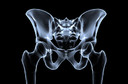 Tratamento da baixa densidade óssea e da osteoporose para prevenção de fraturas: prática clínica do American College of Physicians